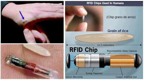 rfid chip 666 xray|microsoft 666 patent.